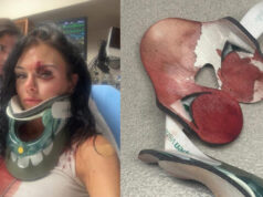 Longview, Texas Hate Crime: Karmelo Anthony Supporters Assault Sammie Lee — The Photos Are Sickening (Video)