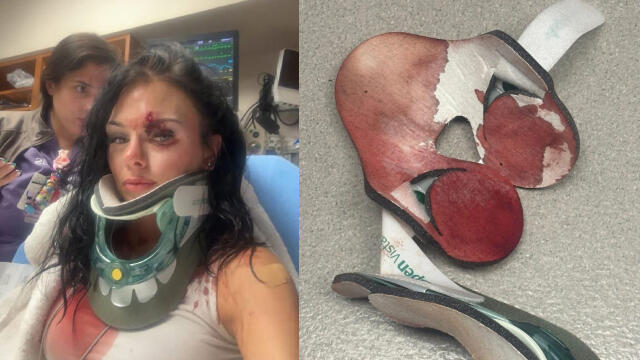 longview-texas-karmelo-anthony-supporters-assault-sammie-lee